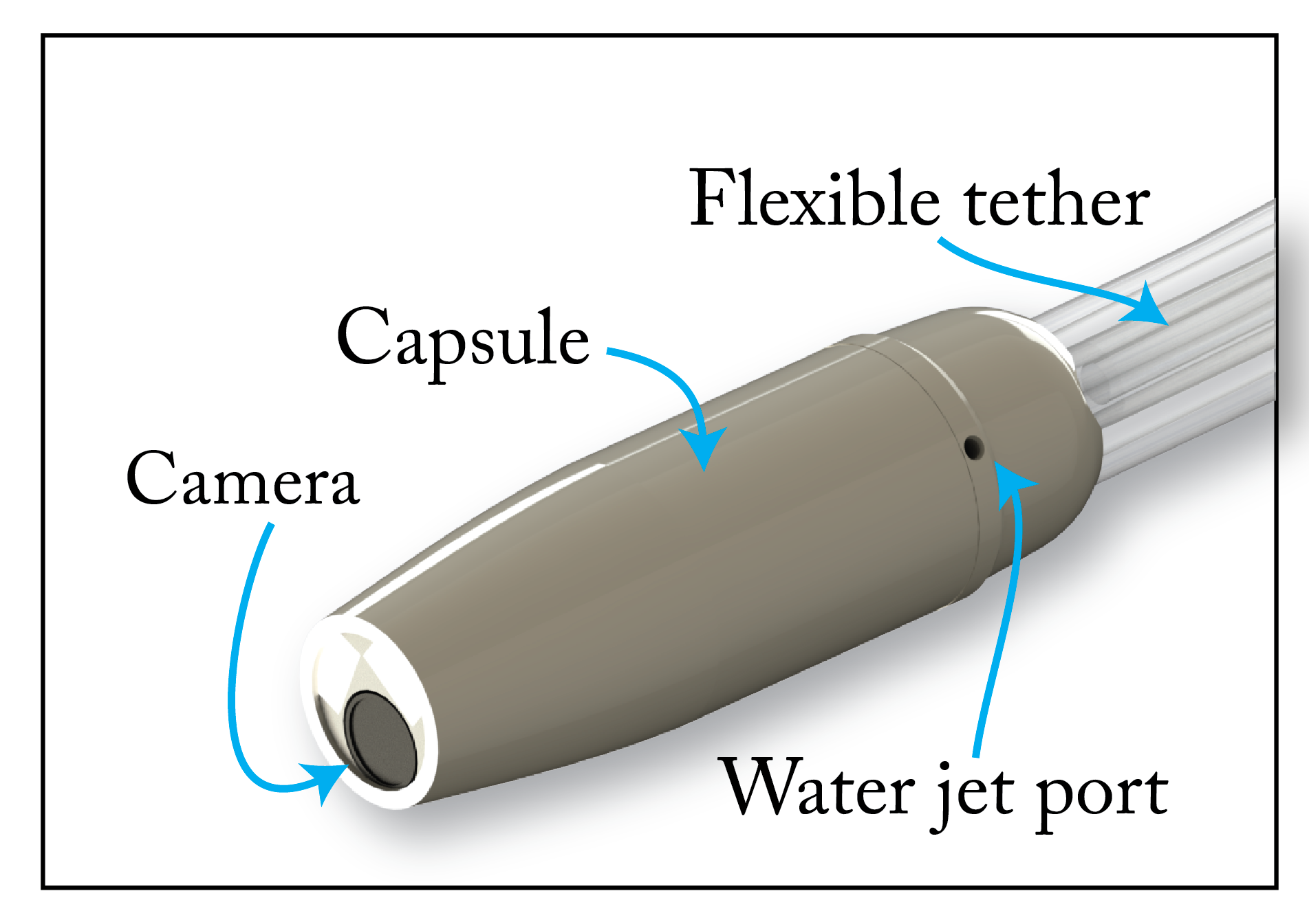 Ultra­low­cost endoscopy for gastric cancer screening in