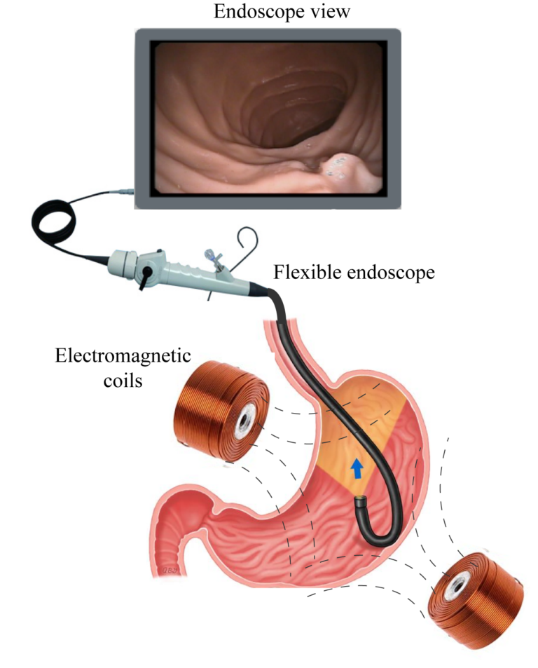 Design of a flexible endoscope Surgical